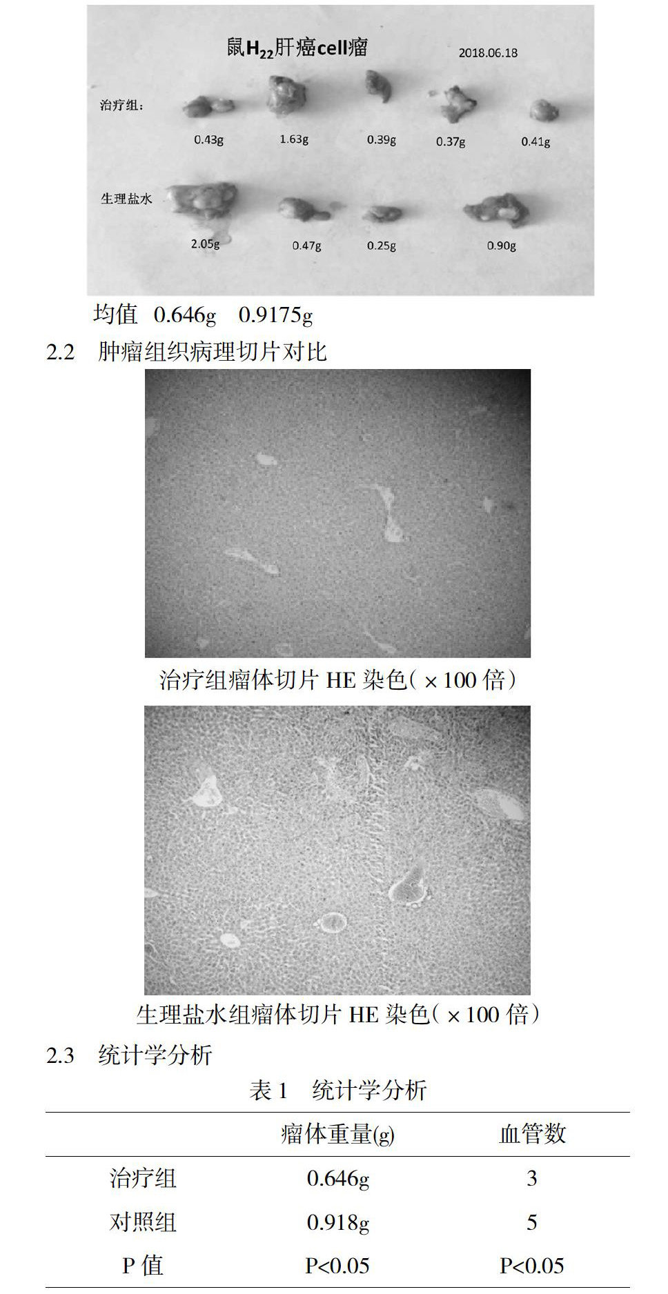 zoޛ)j馝v]:m<V