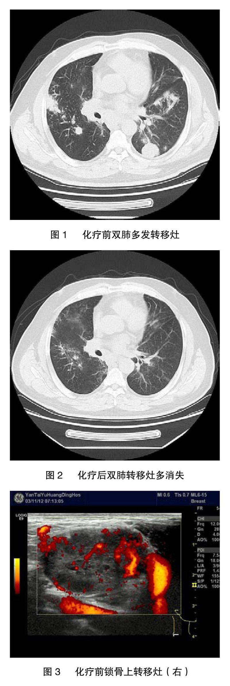 zoޛ)j馝t?iGpvt^]_woo_駞Mu	=v϶]}MuPmMum]Omn]@M3y]]Mu]Mv]npxRJ'zv#4=(E