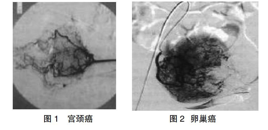 zoޛ)j馔ا]]u]puMv^M9M}v^:V